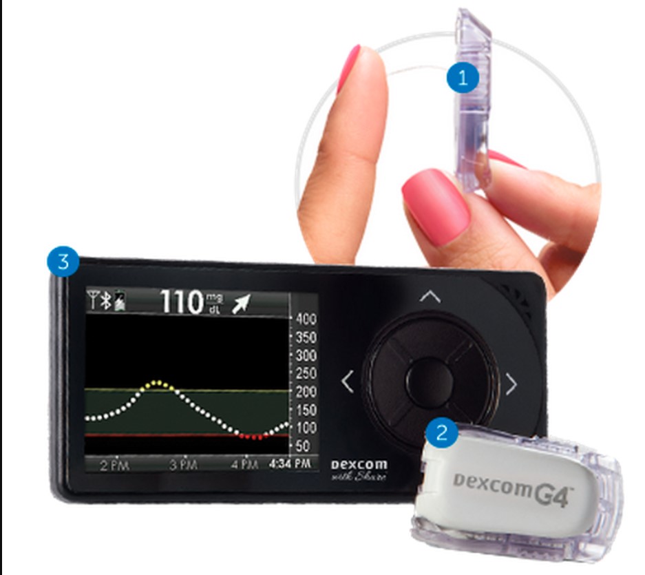 Is Dexcom Better Than Finger Sticks A Comprehensive Comparison