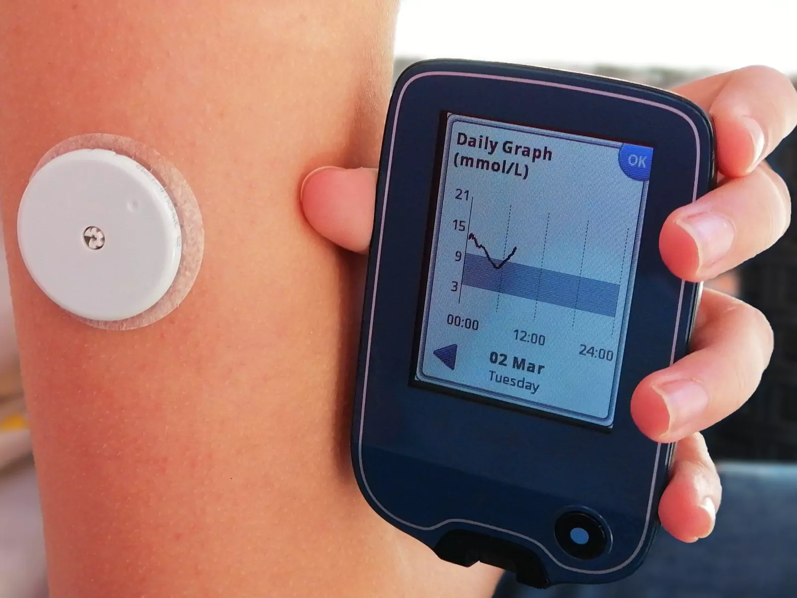 Can I Use a Dexcom for More Than 10 Days?