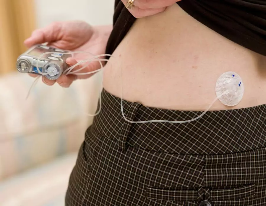 diabetic insulin pump