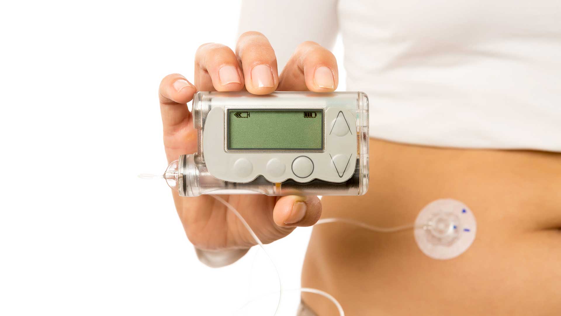 insulin pump working