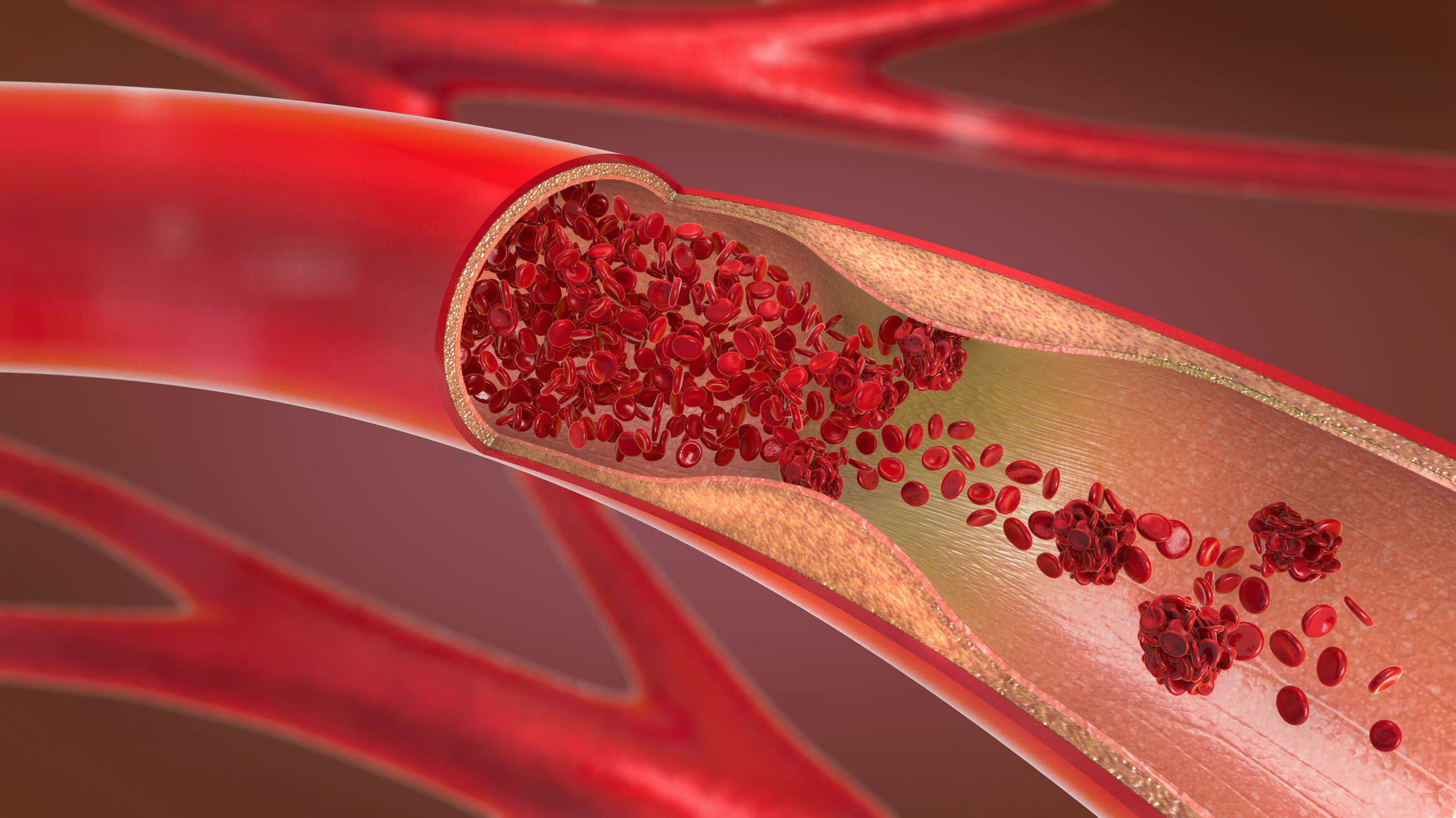 Vascular problems in diabetes
