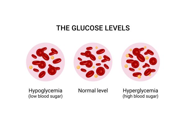 The Role of Diet in Diabetes Management